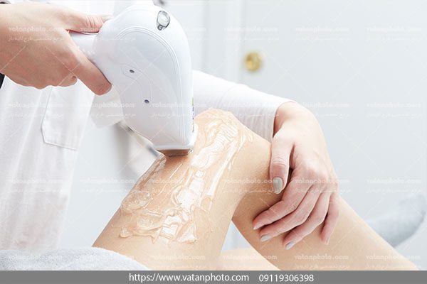عکس لیزر موهای زائد